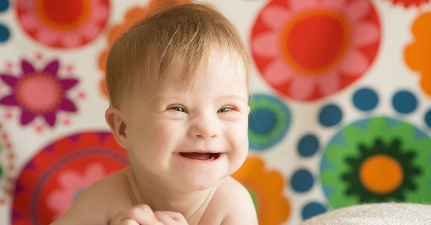 Itt sorstársak segítenek, ha Down-szindrómás babád születik